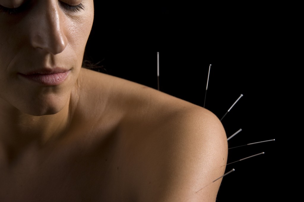 acupuncture shoulder