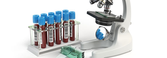 Calgary blood analysis services